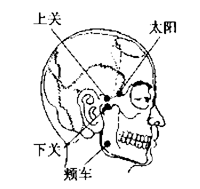 上关穴位位置图 上关穴的功效作用丨一点就通，点穴治病、针灸治病、按摩治病、1d9t.cn